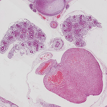 A histology section of a human embryo