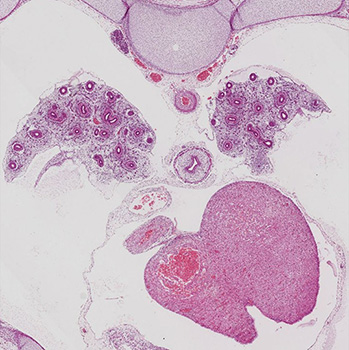 A histology section of a human embryo