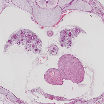 A histology section of a human embryo