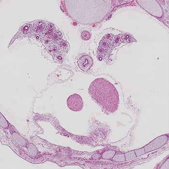 A histology section of a human embryo