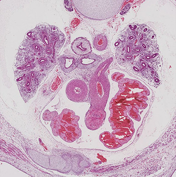 A histology section of a human embryo