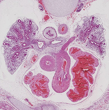 A histology section of a human embryo