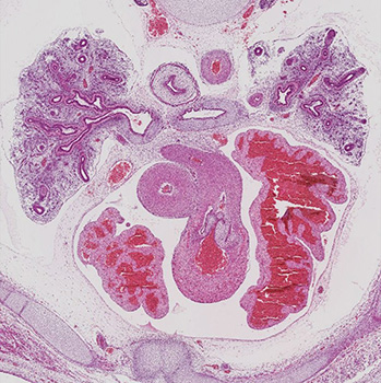 A histology section of a human embryo