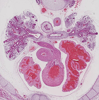 A histology section of a human embryo
