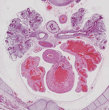 A histology section of a human embryo
