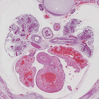 A histology section of a human embryo