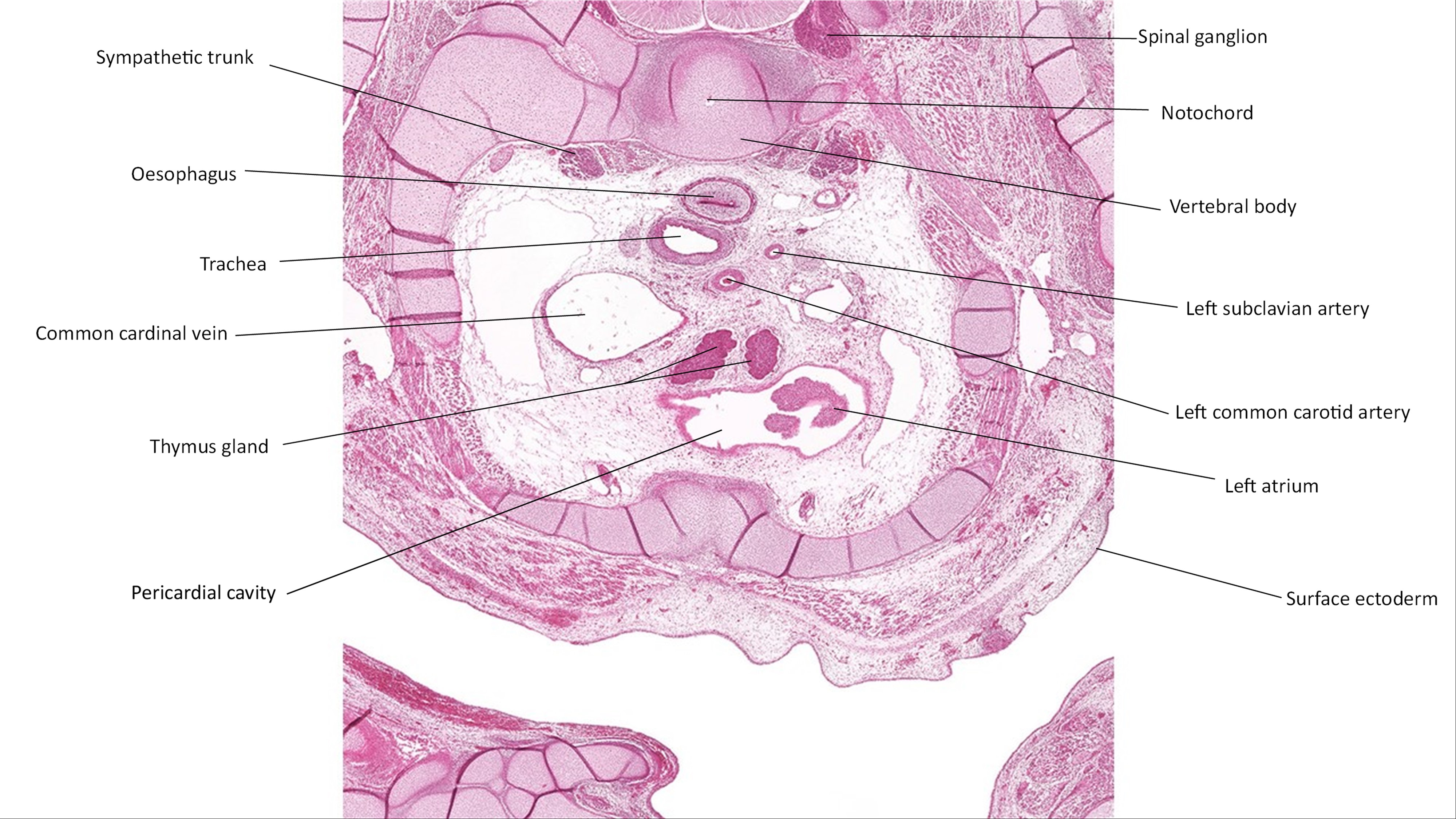 A histology section of a human embryo