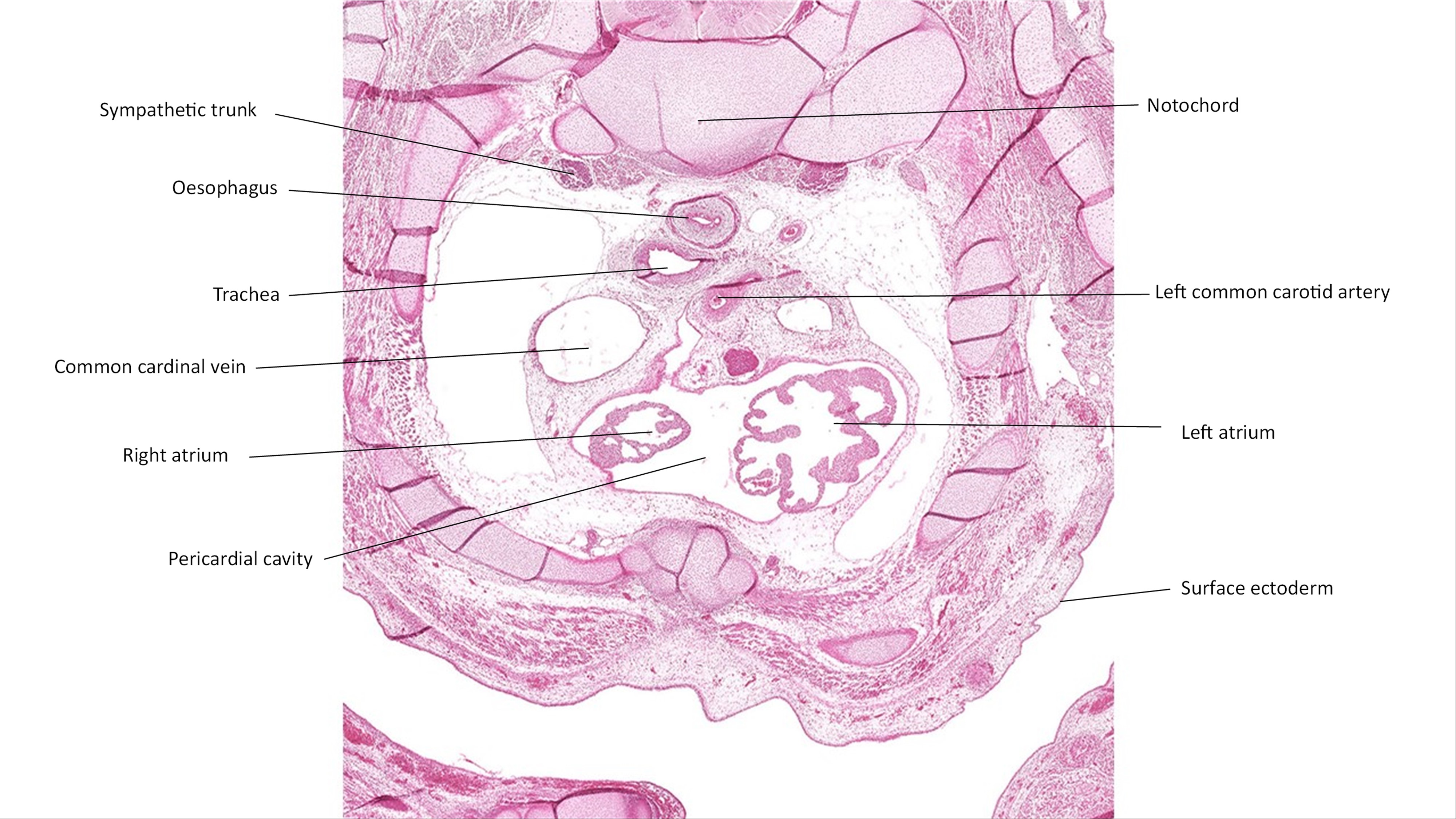 A histology section of a human embryo