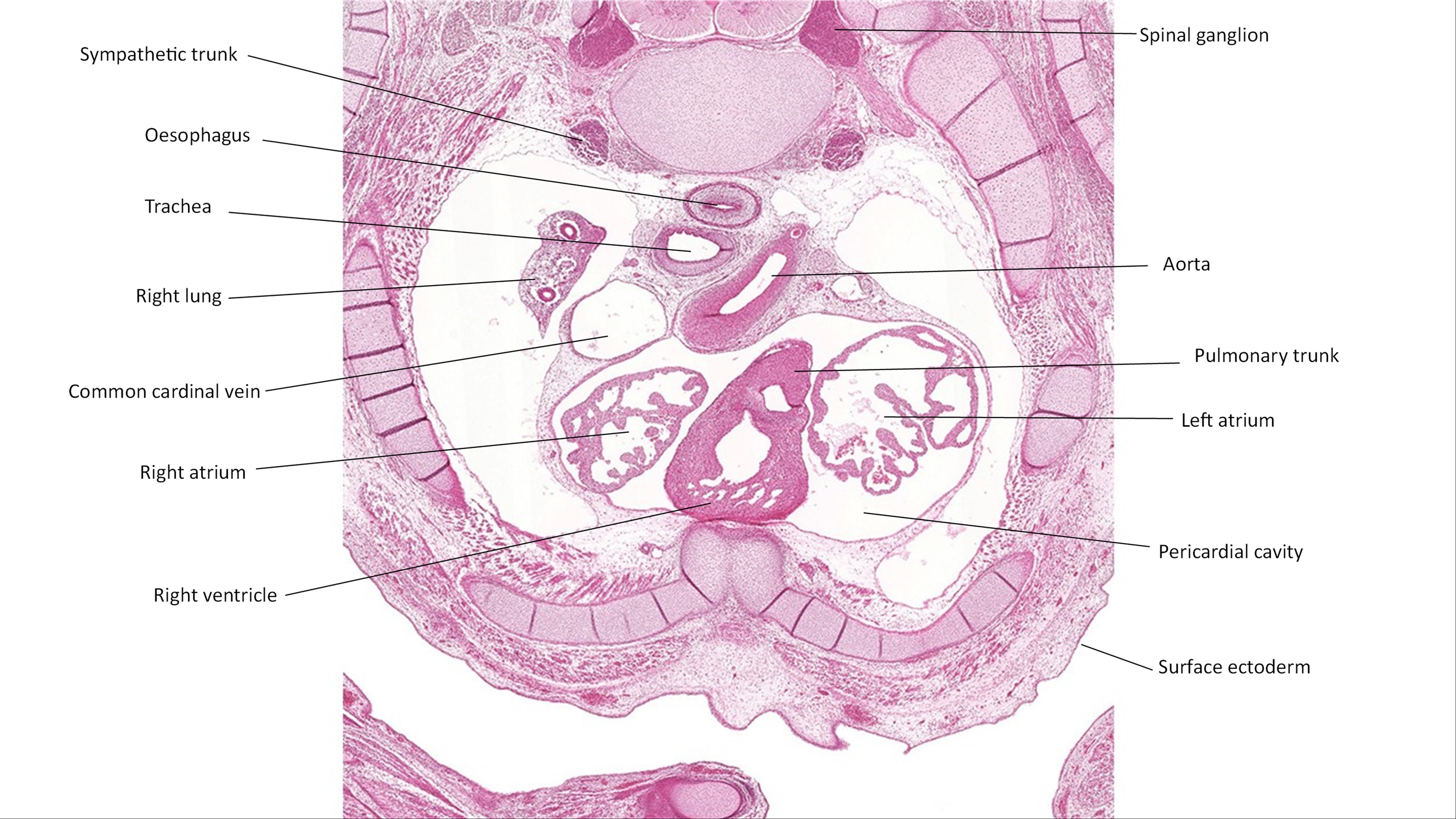 A histology section of a human embryo