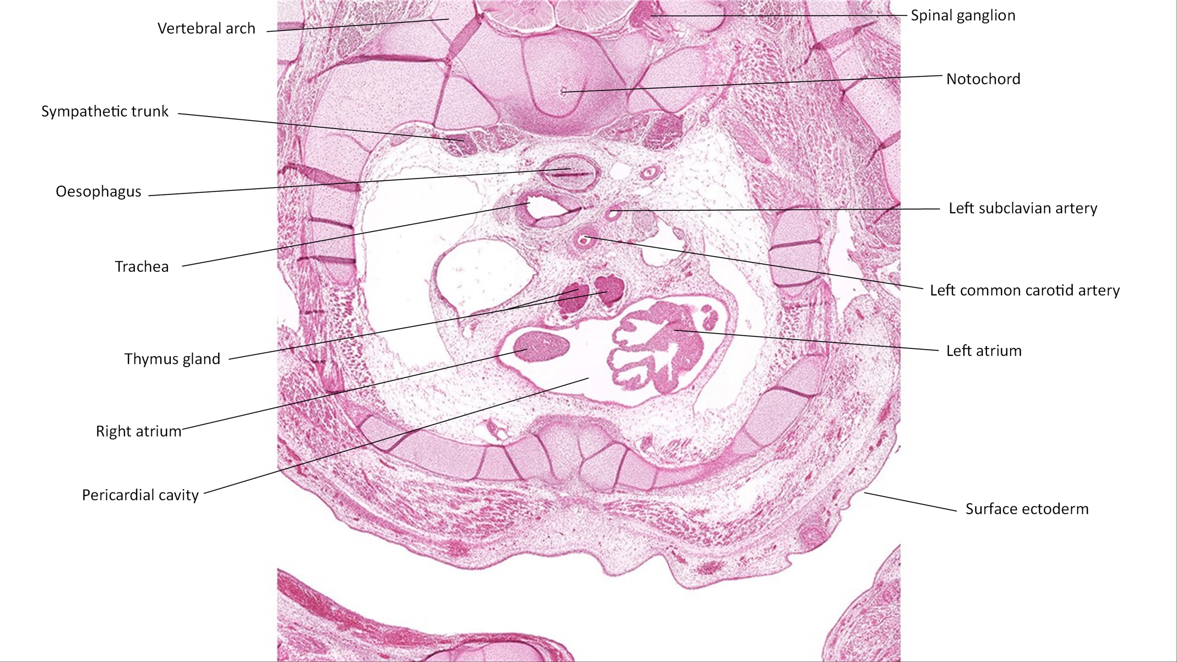 A histology section of a human embryo