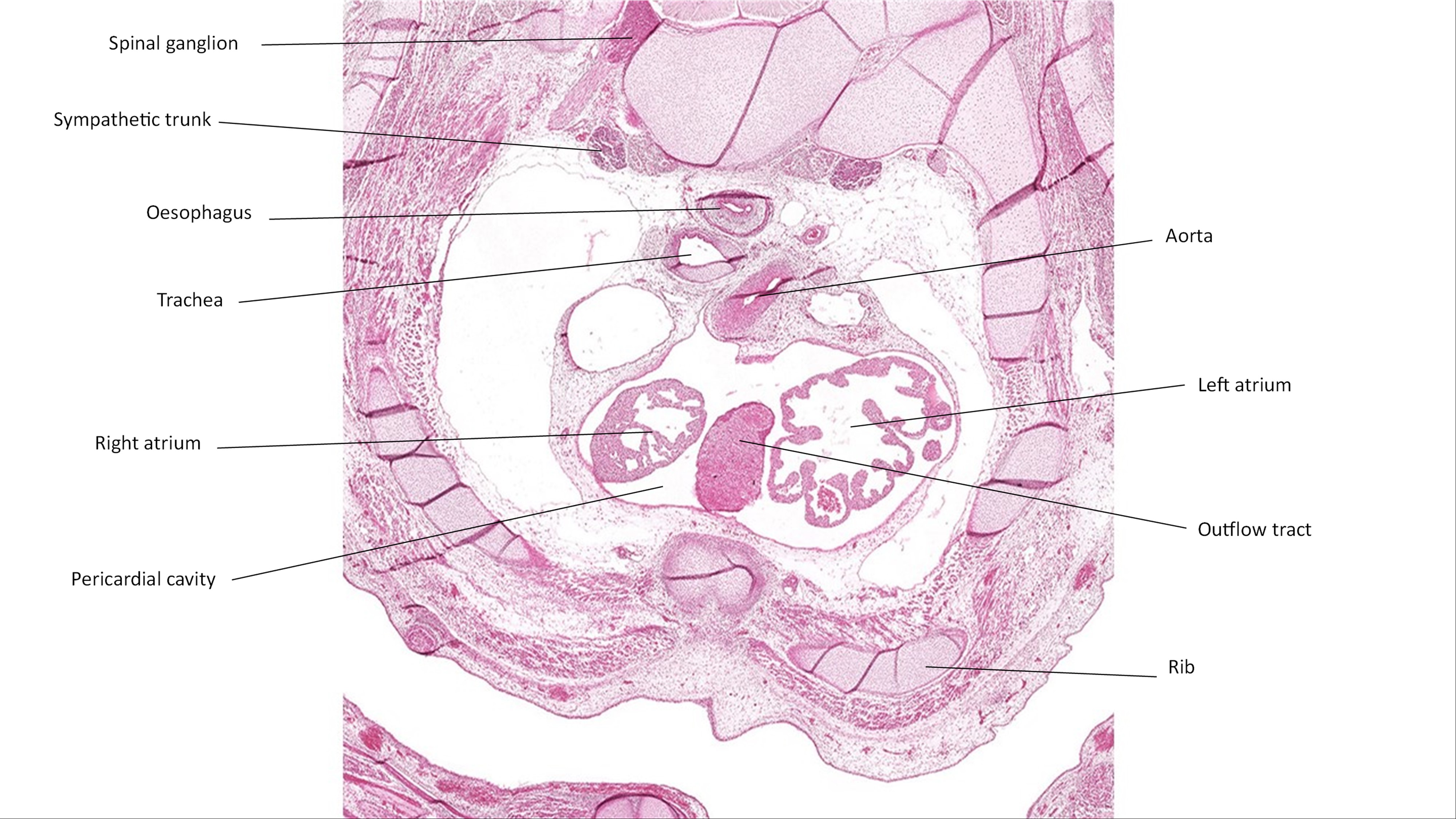 A histology section of a human embryo