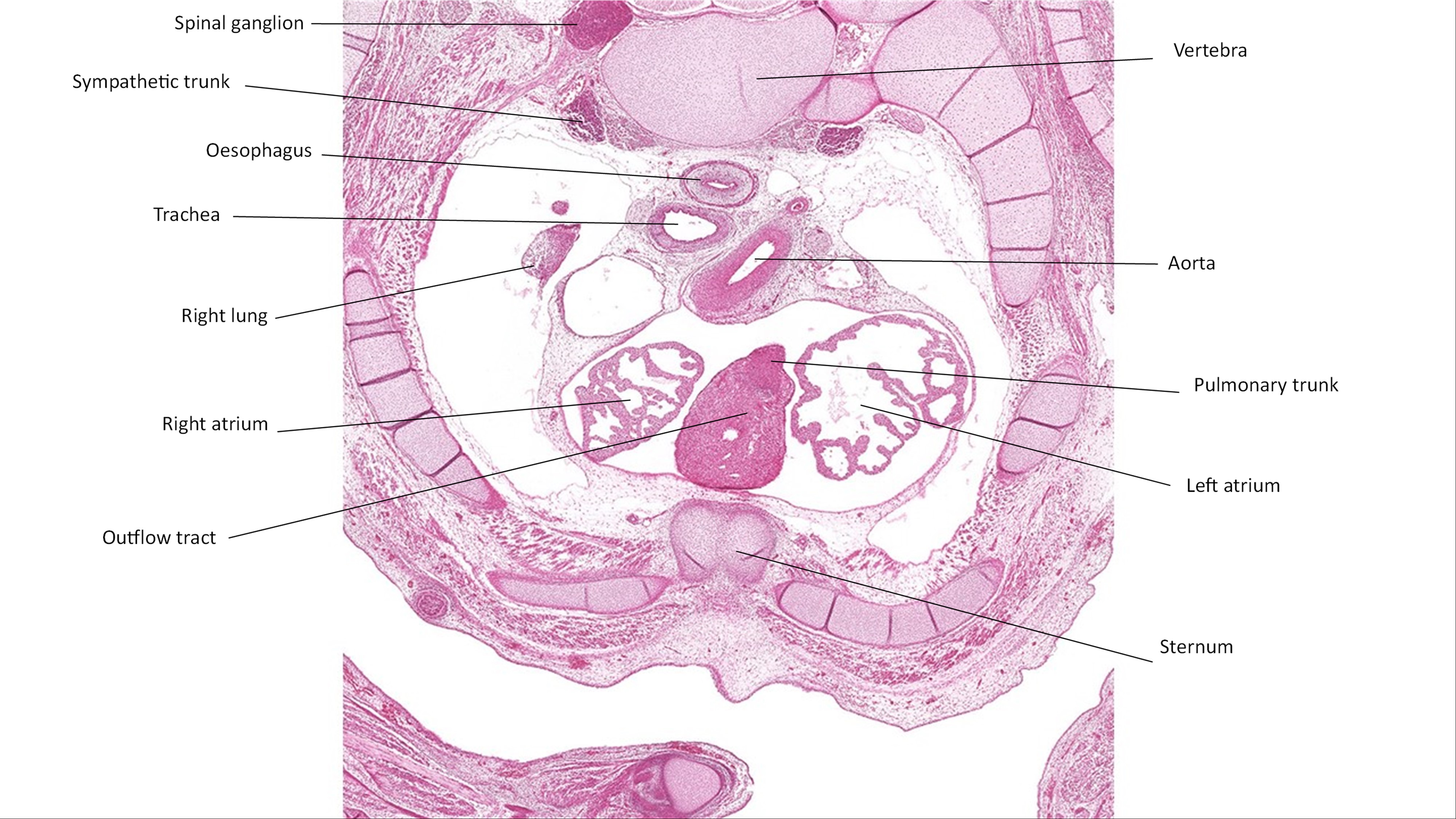 A histology section of a human embryo