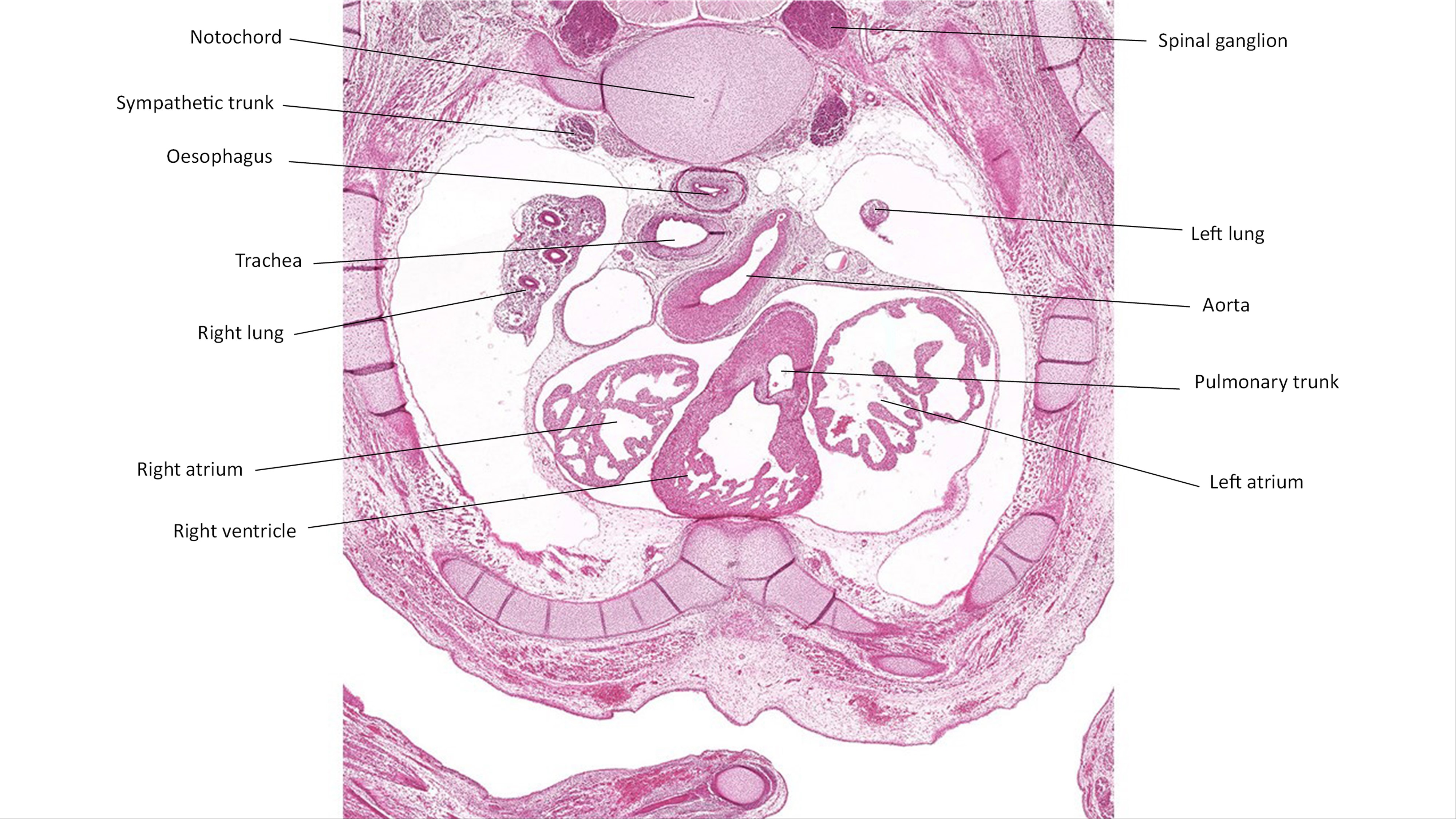 A histology section of a human embryo