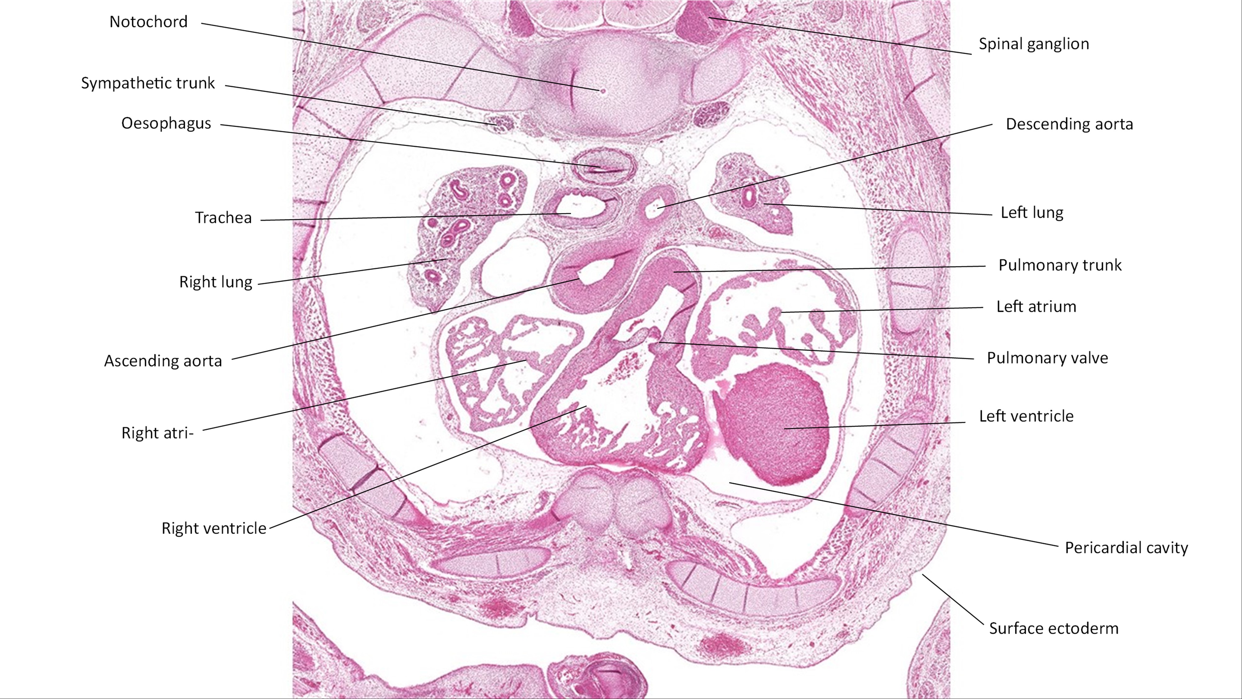 A histology section of a human embryo