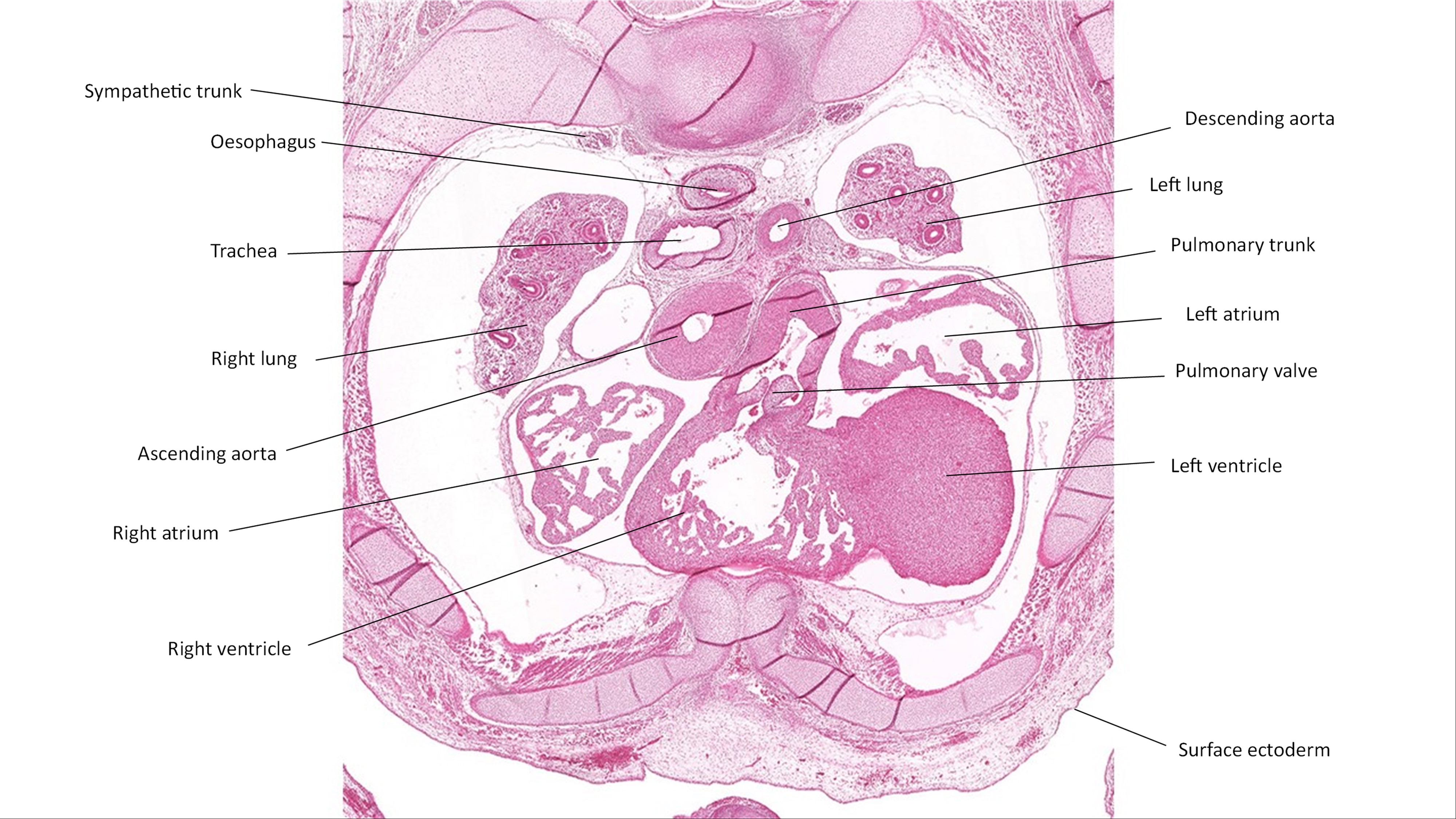 A histology section of a human embryo