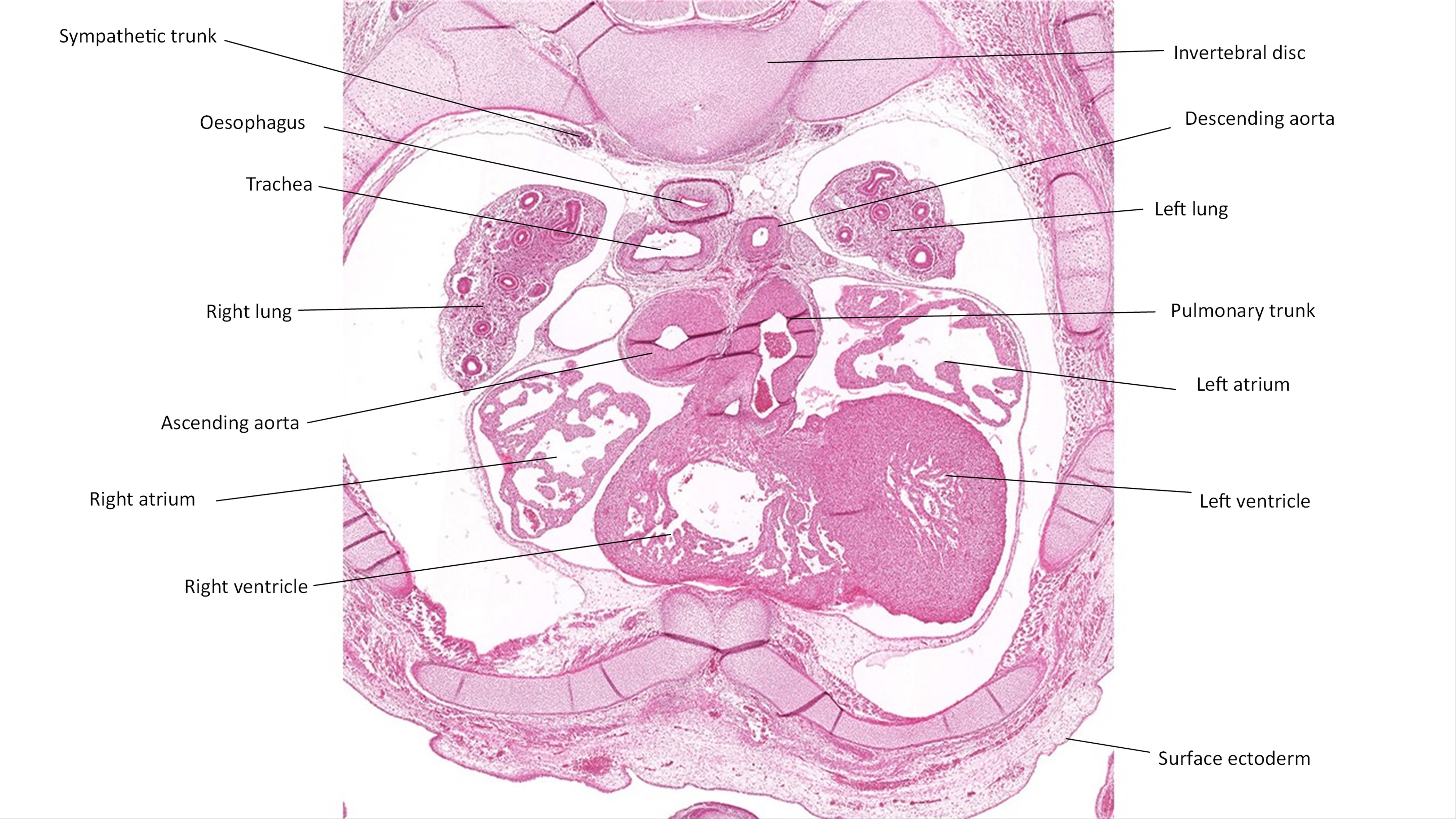 A histology section of a human embryo