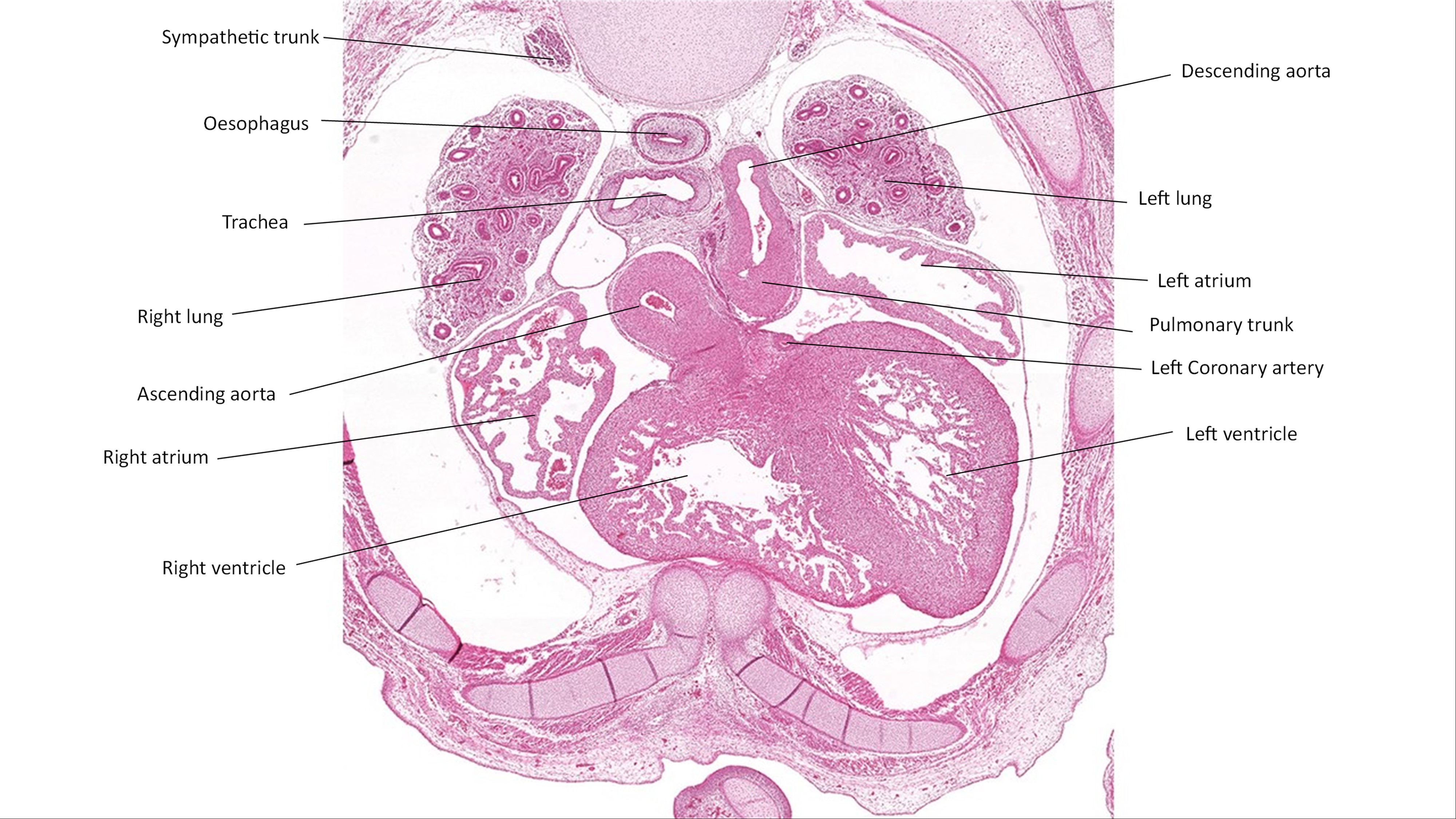 A histology section of a human embryo
