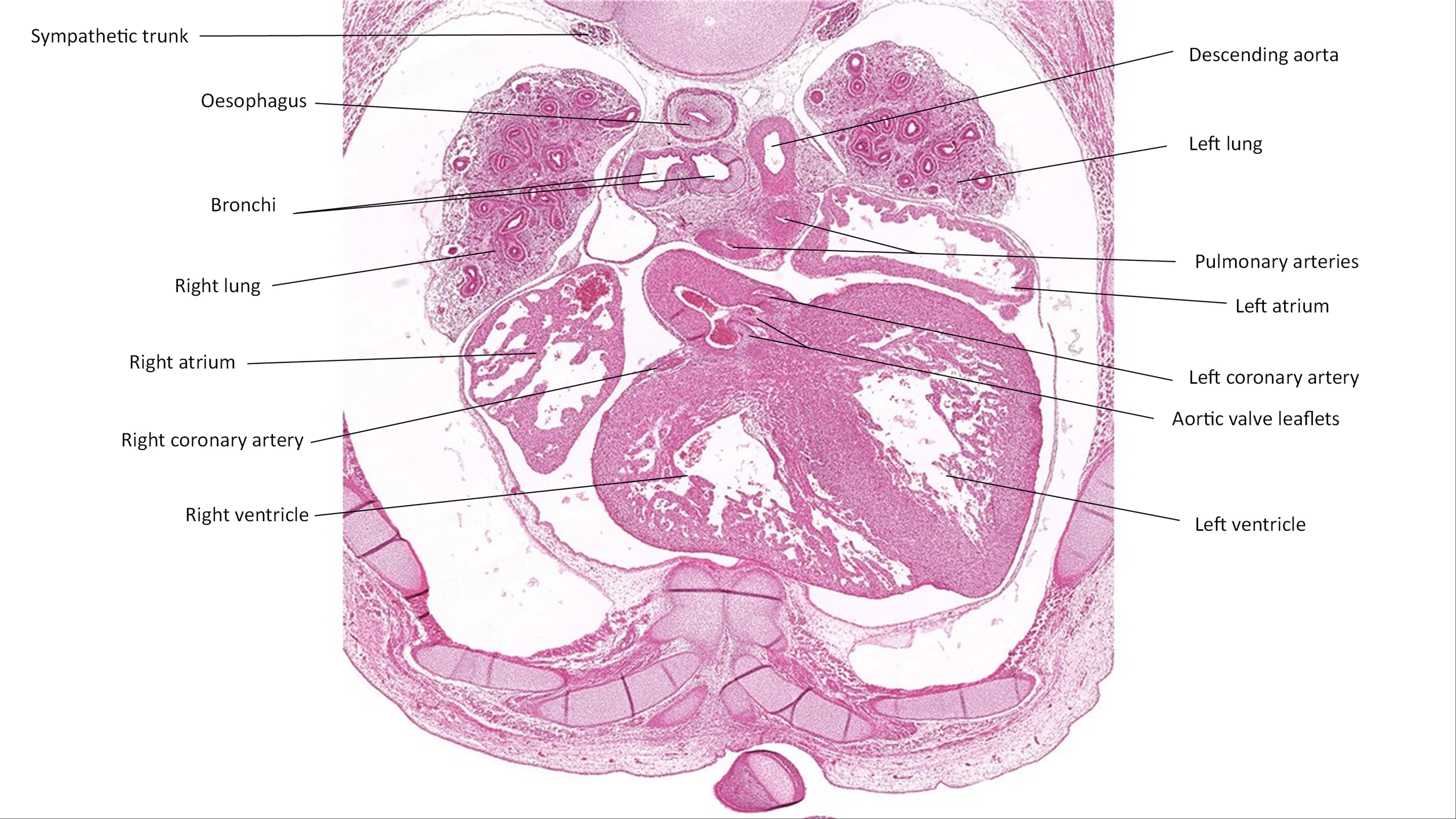 A histology section of a human embryo