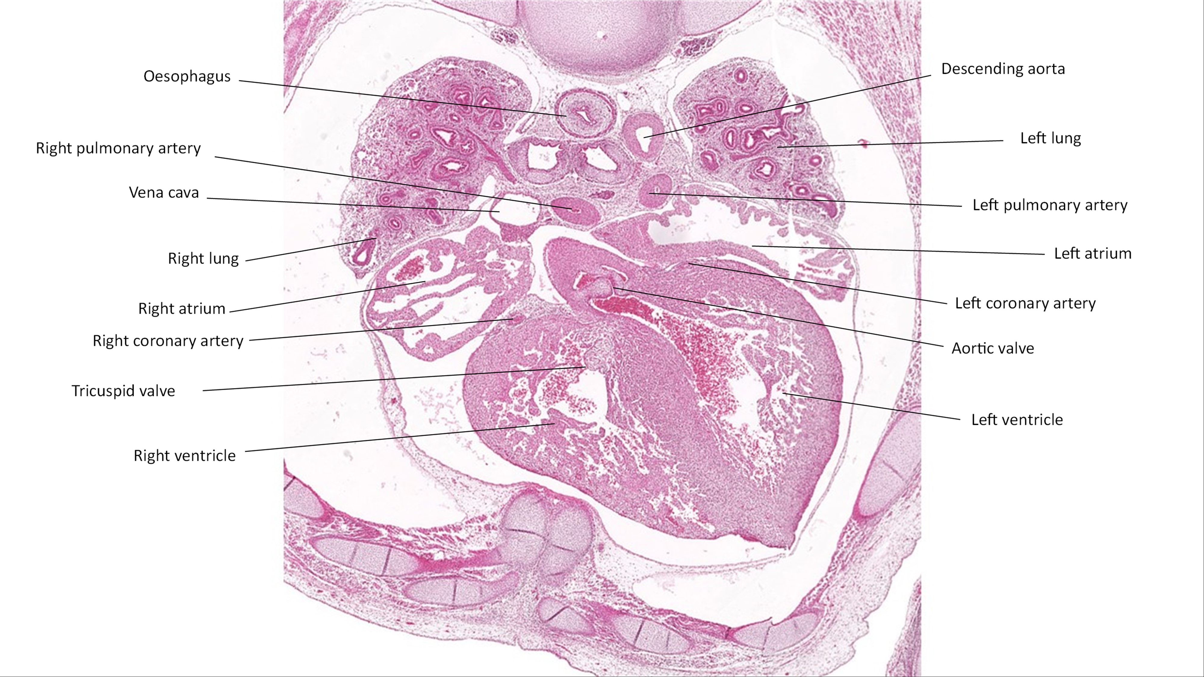 A histology section of a human embryo