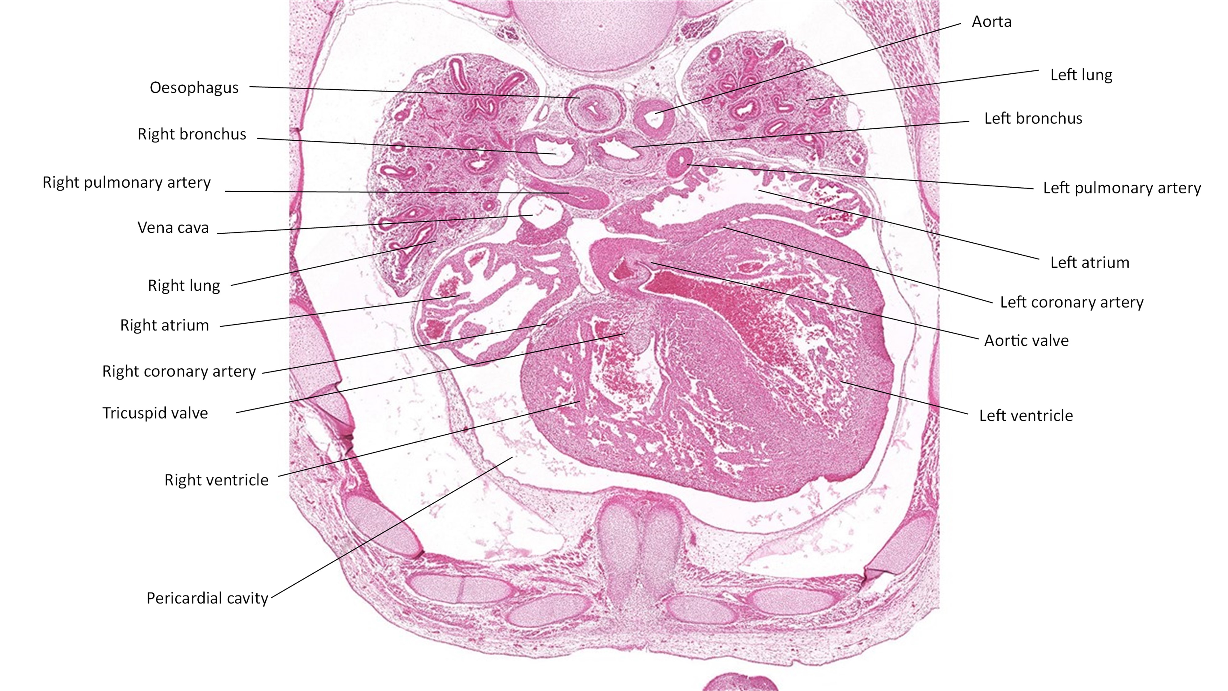 A histology section of a human embryo