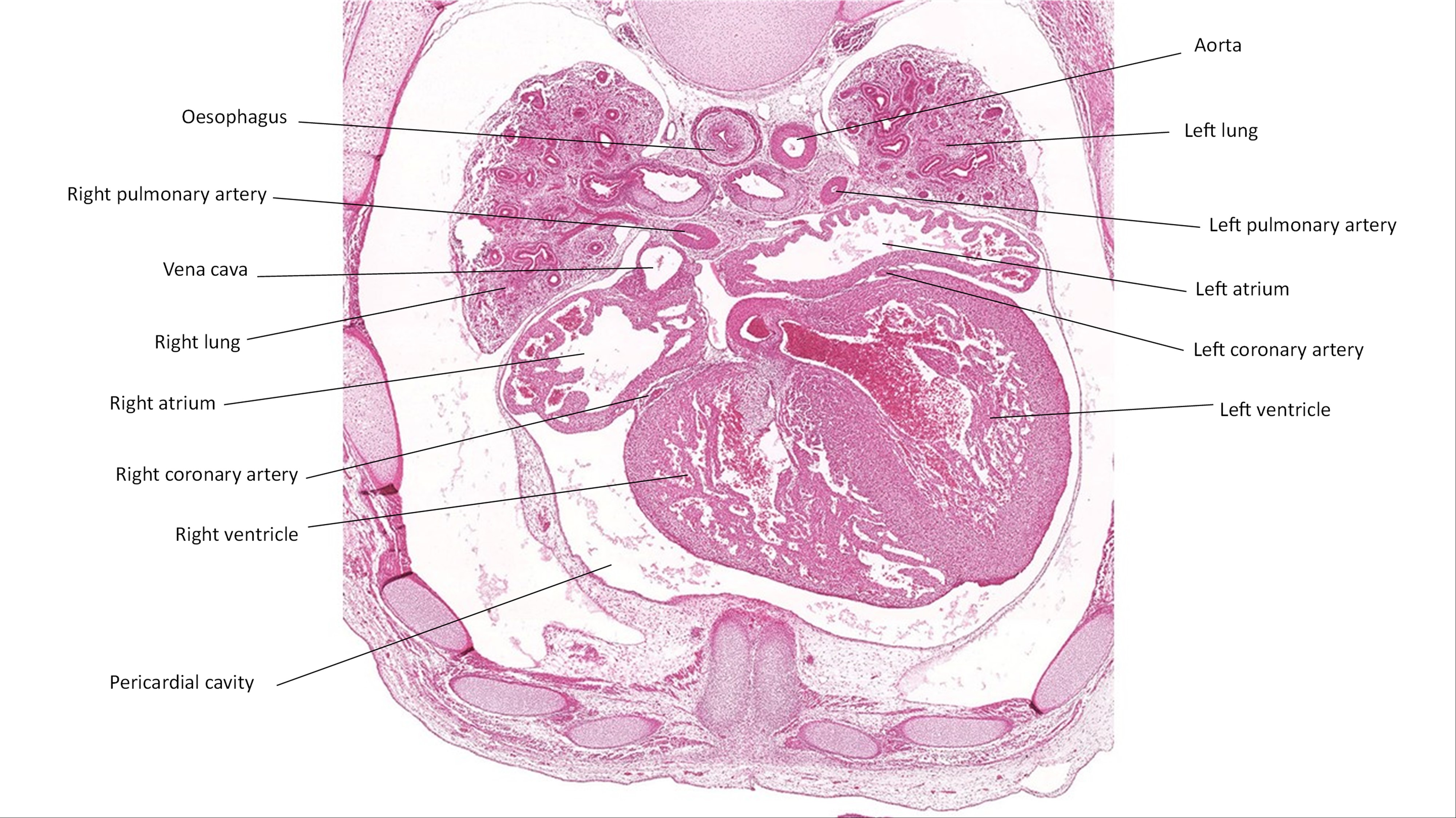 A histology section of a human embryo