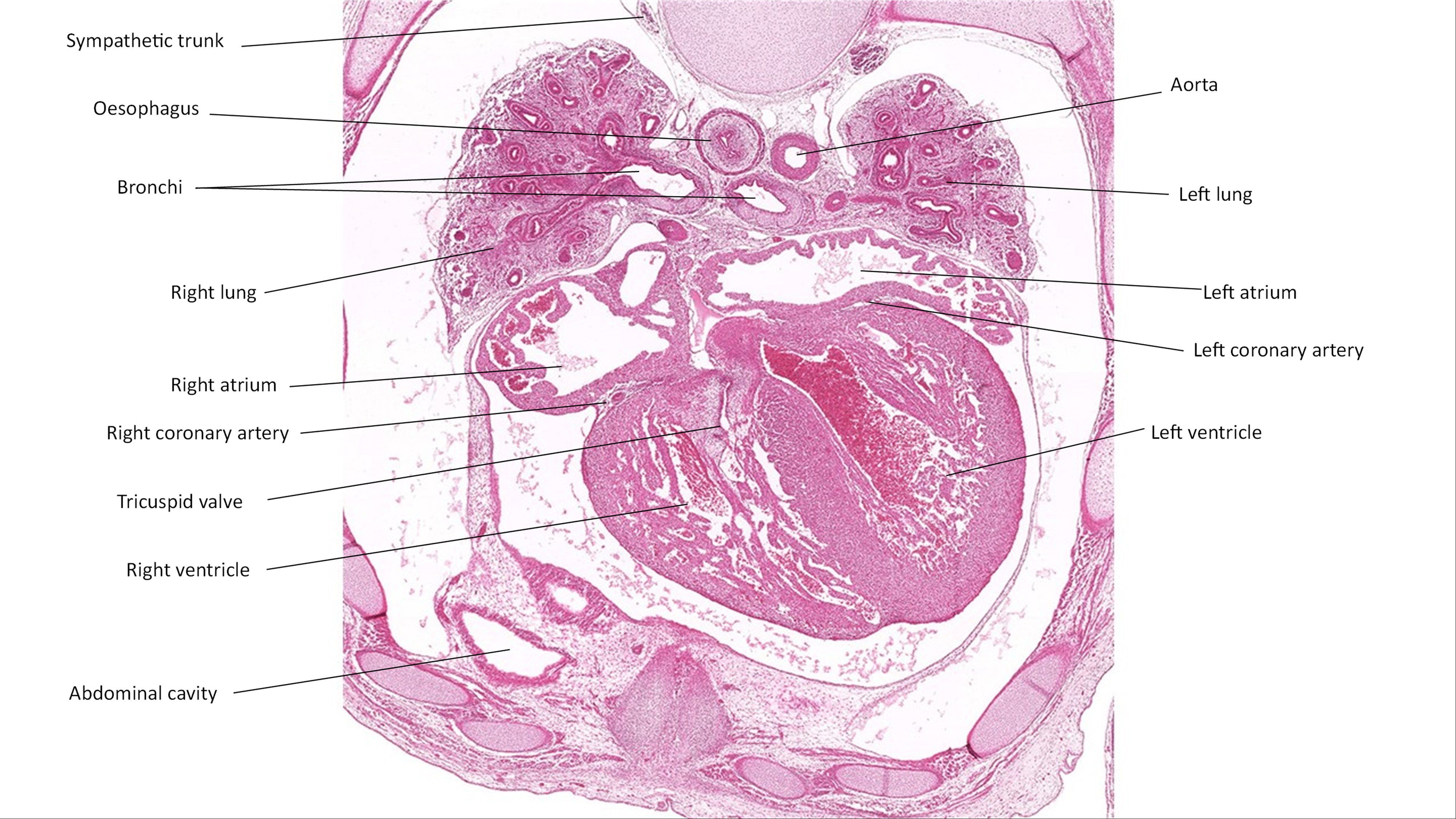 A histology section of a human embryo