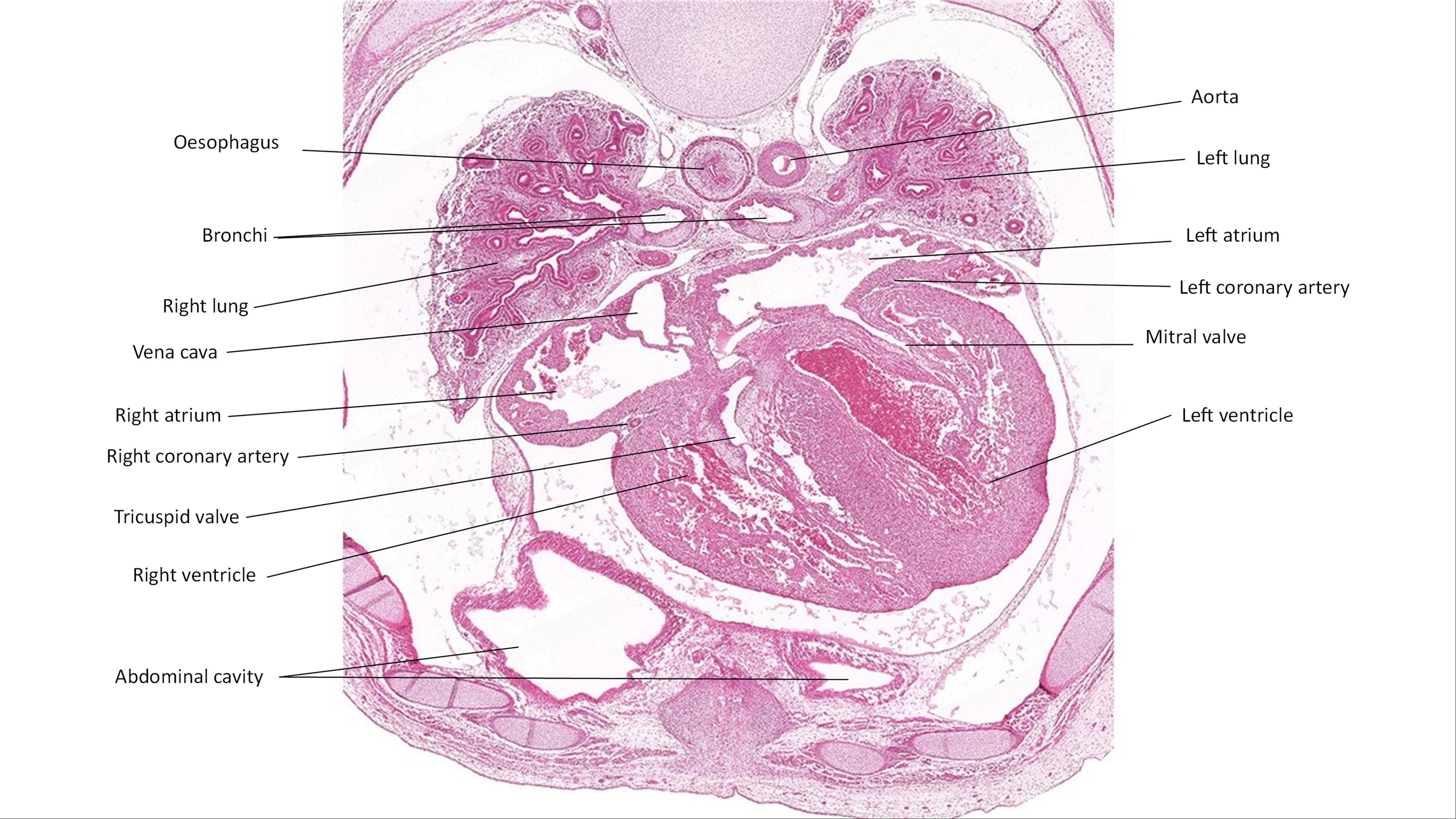 A histology section of a human embryo
