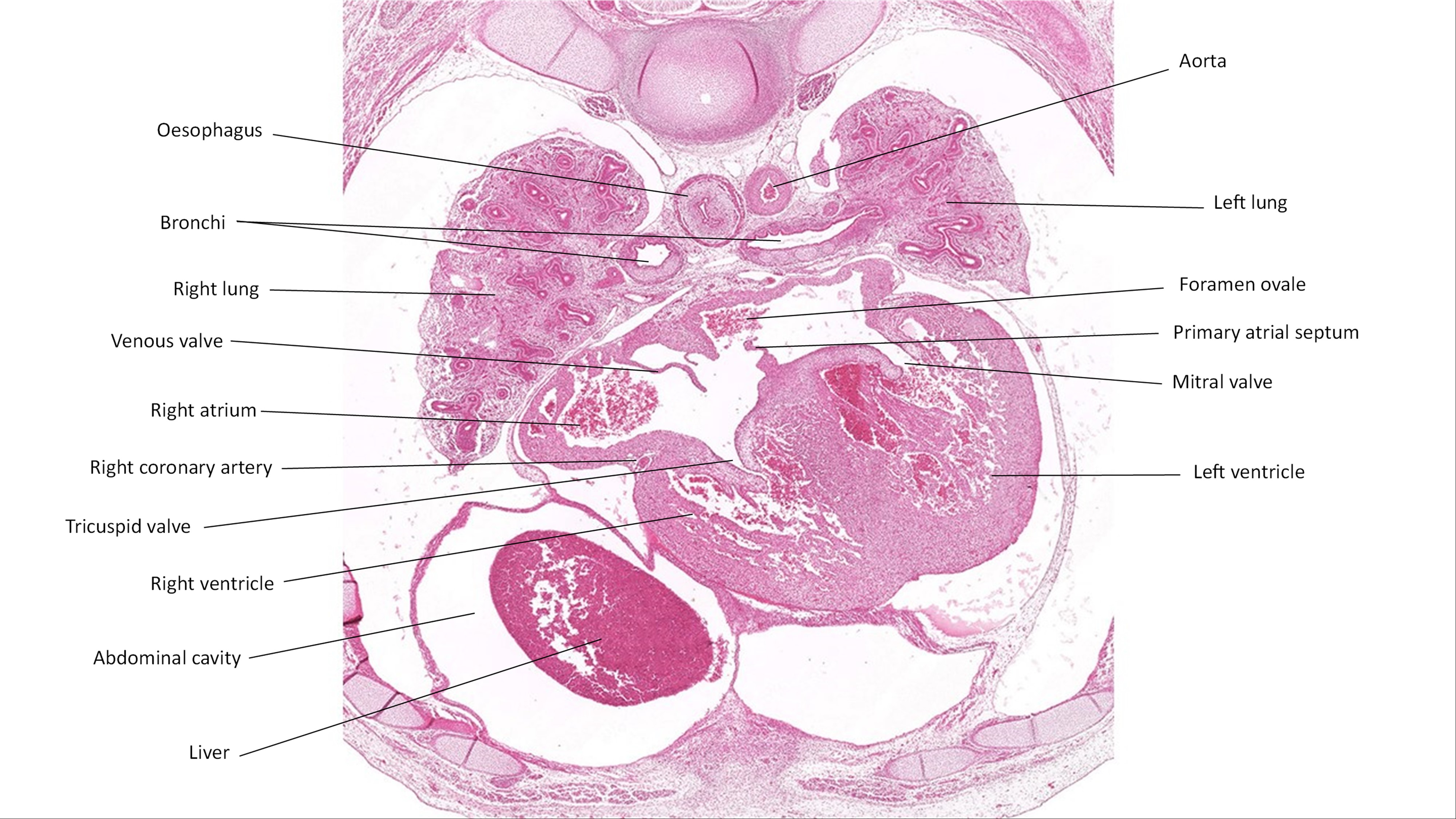 A histology section of a human embryo