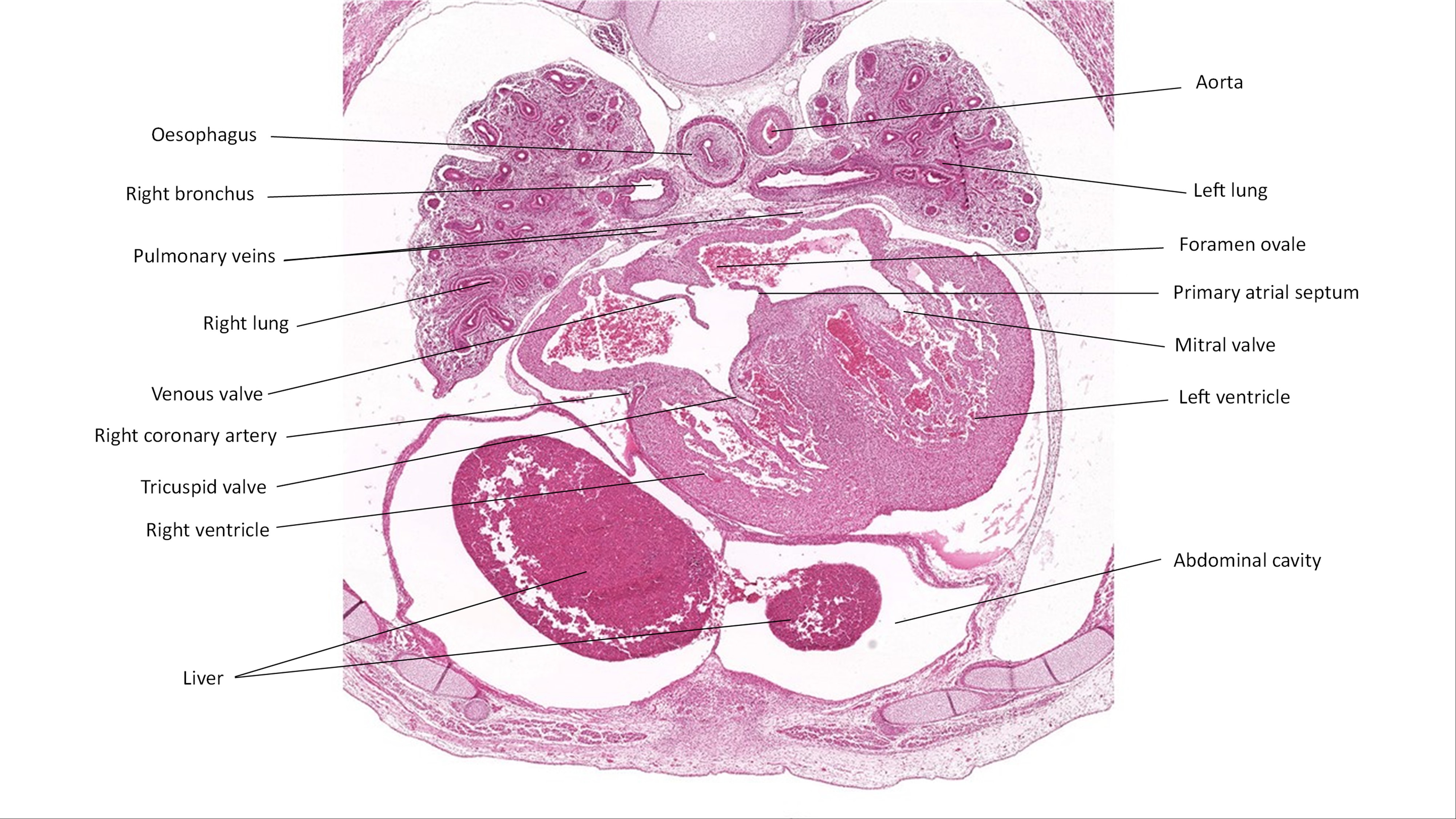 A histology section of a human embryo
