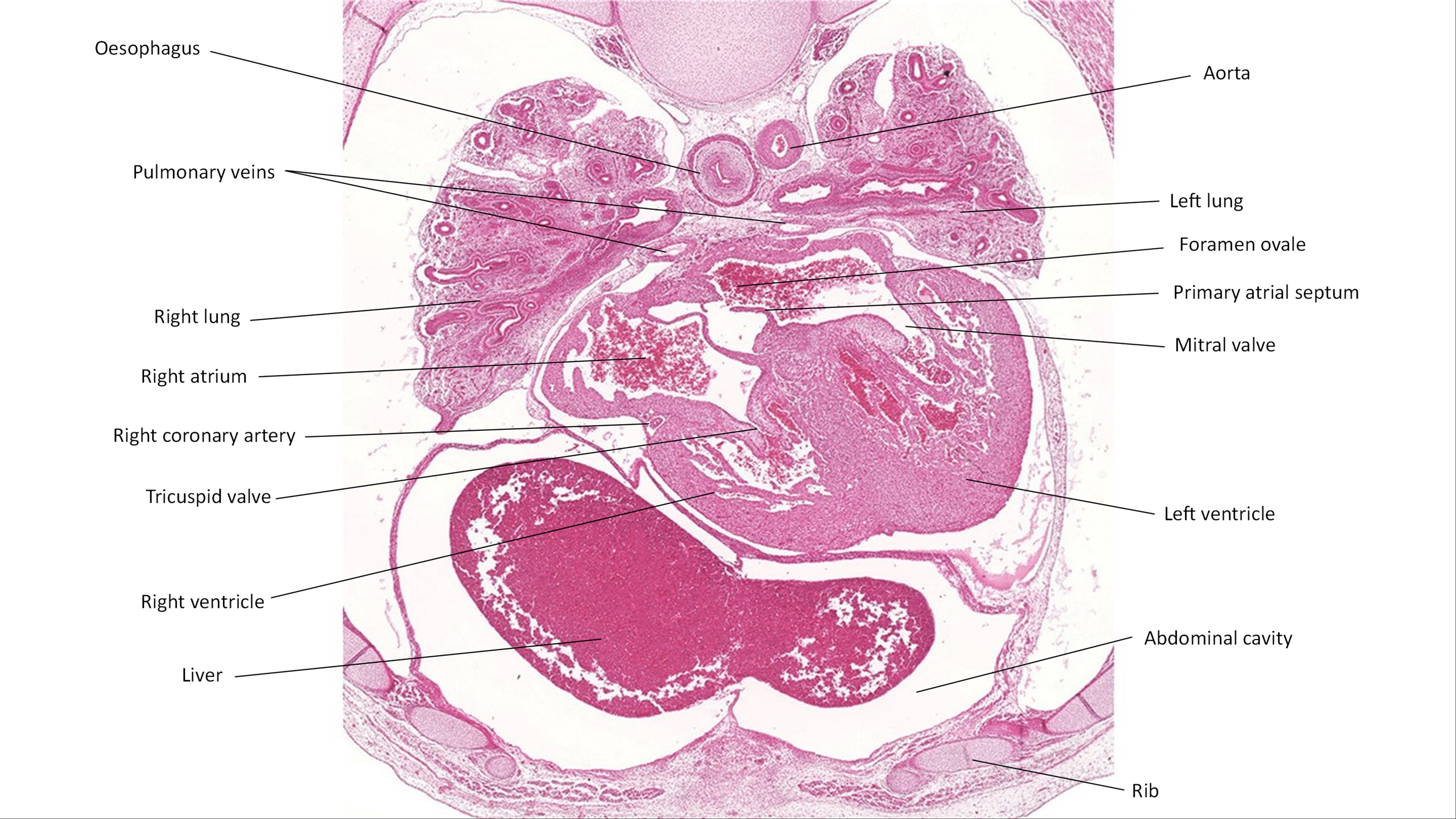 A histology section of a human embryo