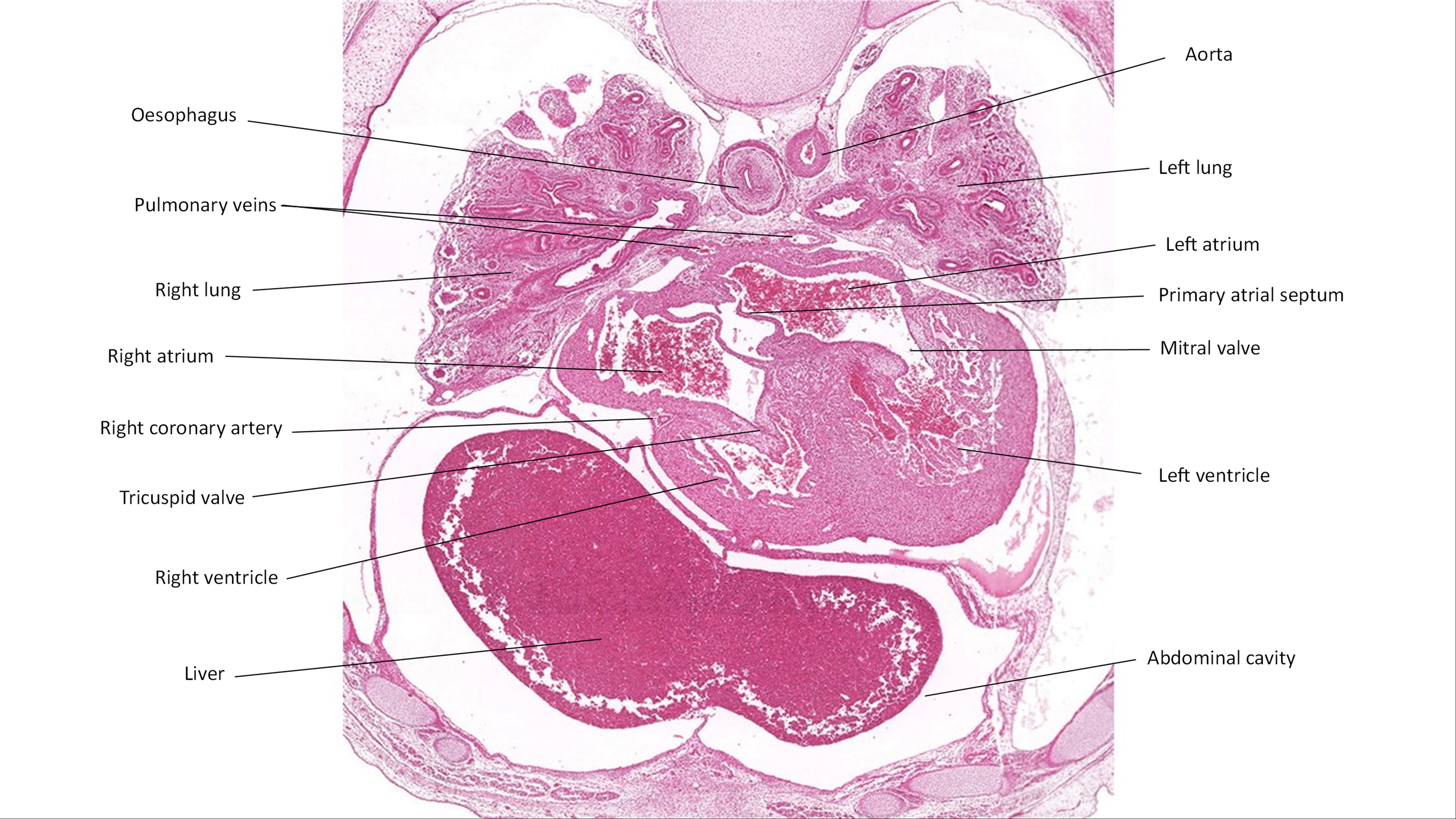 A histology section of a human embryo