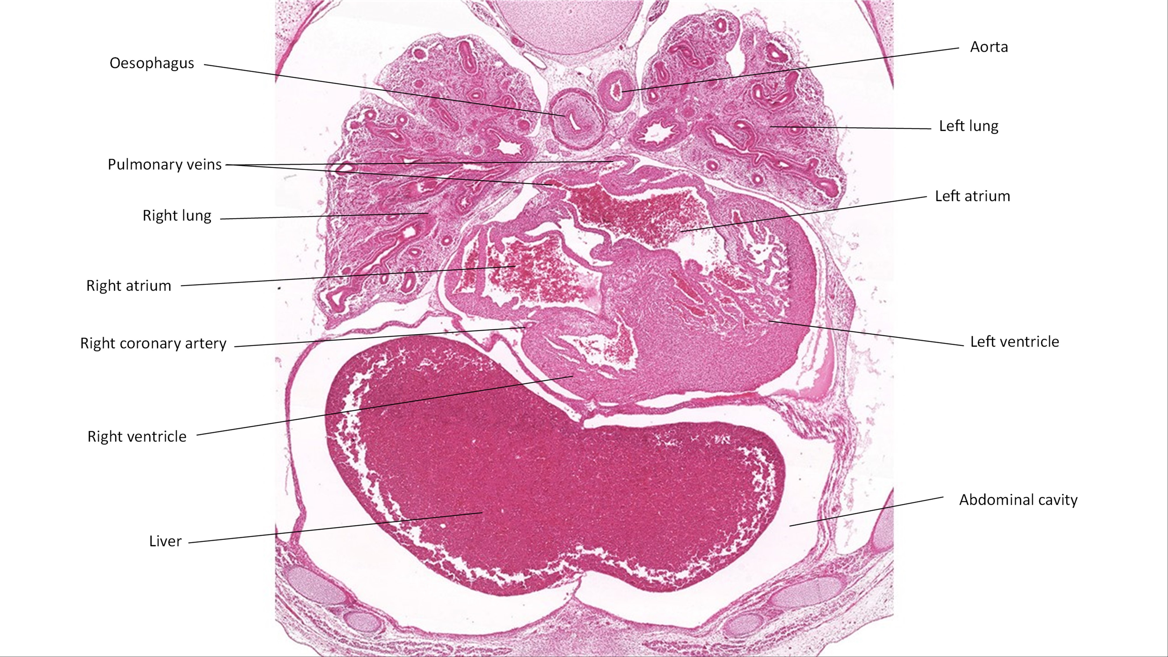 A histology section of a human embryo