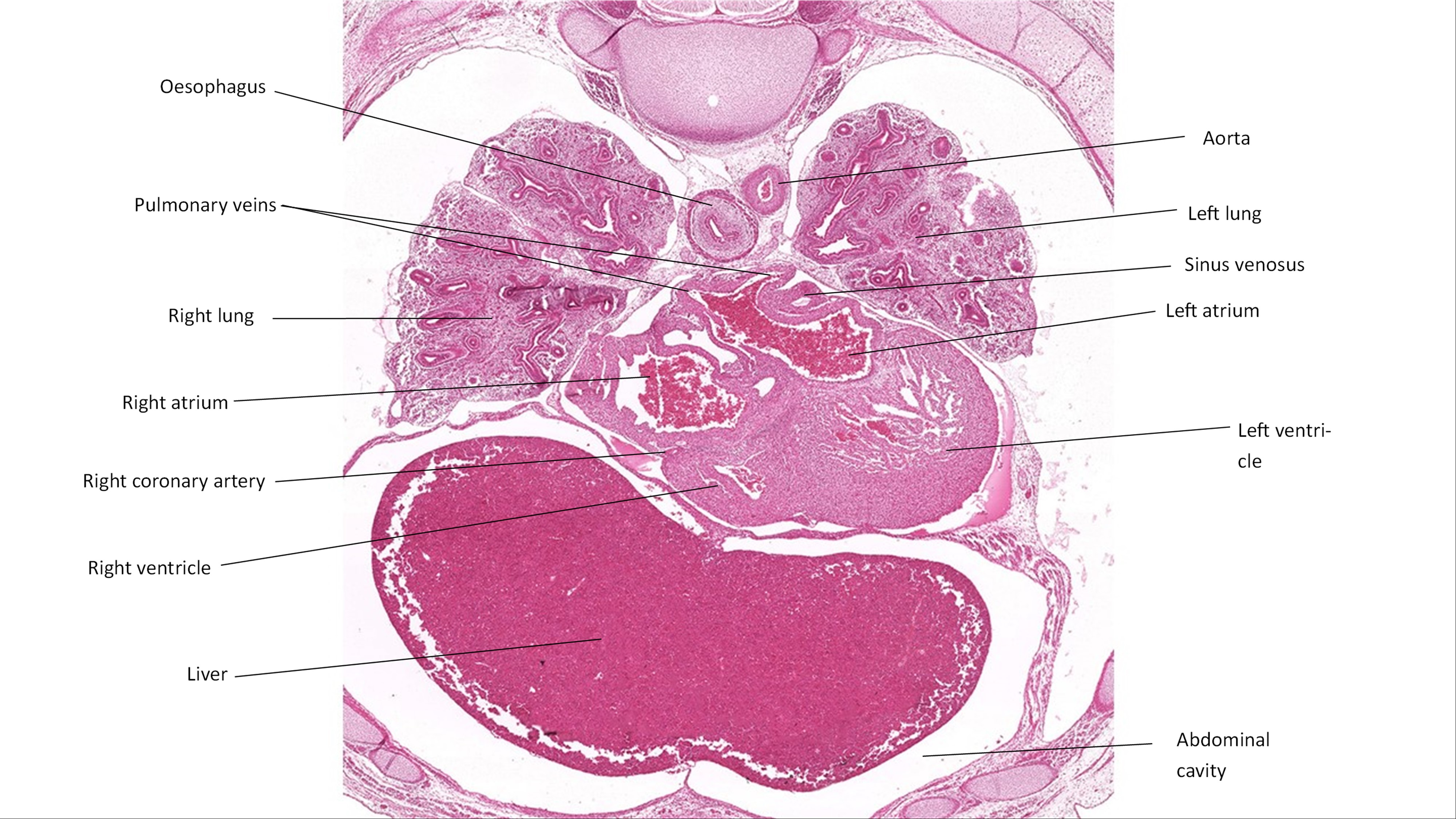 A histology section of a human embryo