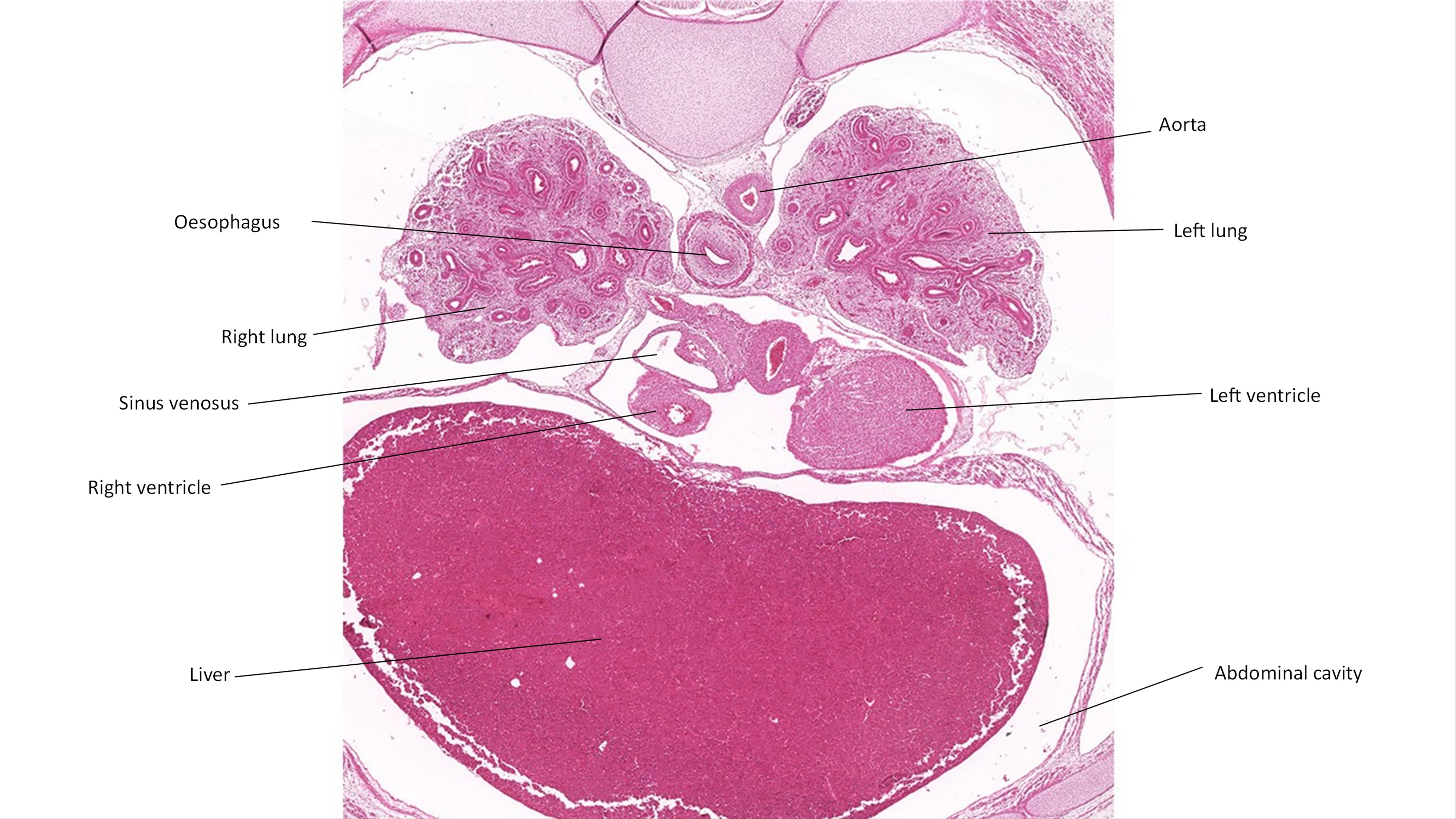 A histology section of a human embryo