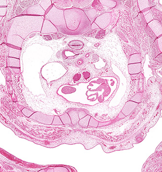 A histology section of a human embryo