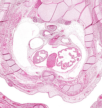 A histology section of a human embryo
