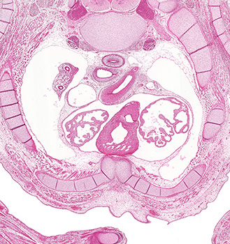 A histology section of a human embryo