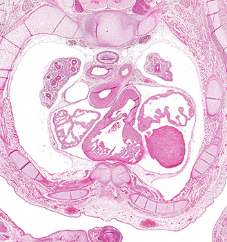 A histology section of a human embryo