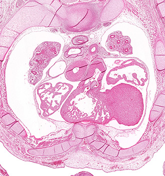 A histology section of a human embryo