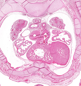 A histology section of a human embryo