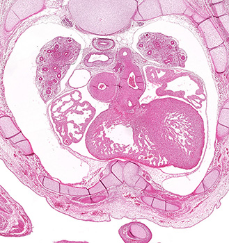 a histology section of a human embryo