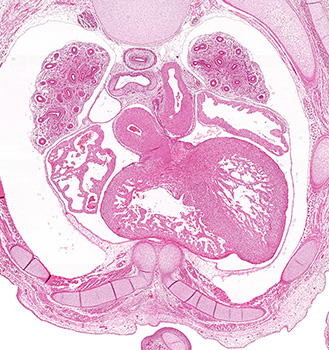 A histology section of a human embryo