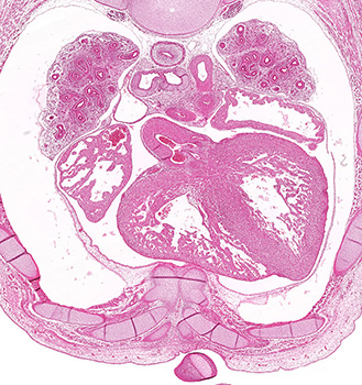 A histology section of a human embryo