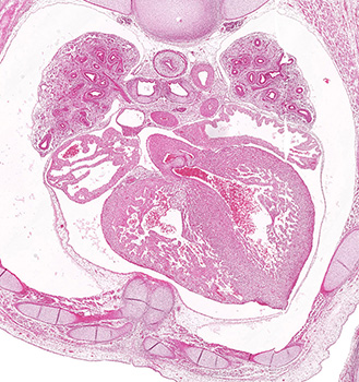 A histology section of a human embryo