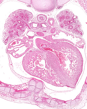 A histology section of a human embryo