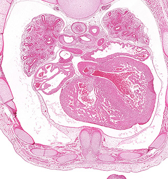 A histology section of a human embryo