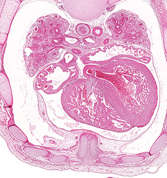 A histology section of a human embryo
