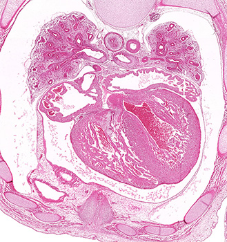 A histology section of a human embryo
