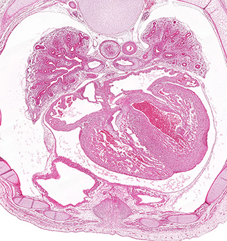 A histology section of a human embryo