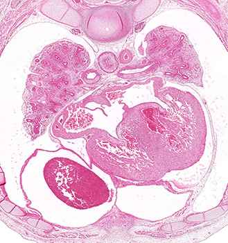 A histology section of a human embryo